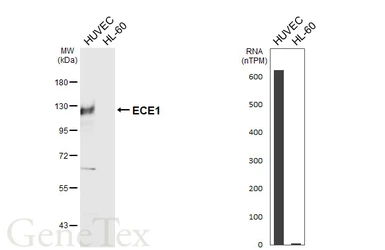 Anti-ECE1 antibody [HL6991] used in Western Blot (WB). GTX649853