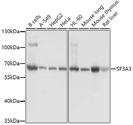 Anti-SF3A3 antibody used in Western Blot (WB). GTX64988
