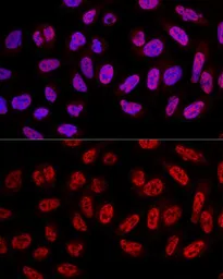 Anti-SF3A3 antibody used in Immunocytochemistry/ Immunofluorescence (ICC/IF). GTX64988