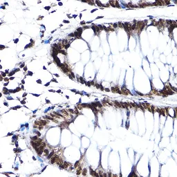 Anti-SF3A3 antibody used in IHC (Paraffin sections) (IHC-P). GTX64988