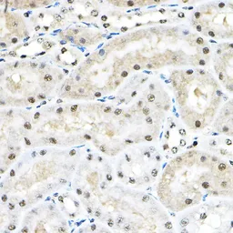 Anti-SF3A3 antibody used in IHC (Paraffin sections) (IHC-P). GTX64988