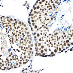 Anti-SF3A3 antibody used in IHC (Paraffin sections) (IHC-P). GTX64988