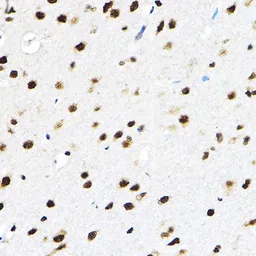 Anti-SF3A3 antibody used in IHC (Paraffin sections) (IHC-P). GTX64988
