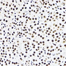 Anti-SF3A3 antibody used in IHC (Paraffin sections) (IHC-P). GTX64988