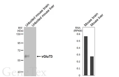 Anti-vGluT3 antibody [HL7007] used in Western Blot (WB). GTX649880