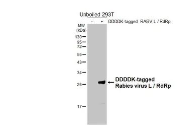 Anti-Rabies virus L / RdRp antibody [HL7010] used in Western Blot (WB). GTX649883