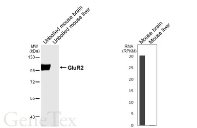 Anti-GluR2 antibody [HL7015] used in Western Blot (WB). GTX649888
