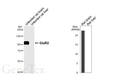 Anti-GluR2 antibody [HL7015] used in Western Blot (WB). GTX649888