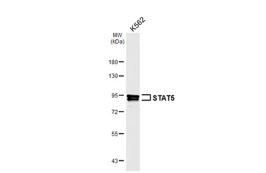 Anti-STAT5 antibody [HL7028] used in Western Blot (WB). GTX649901