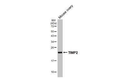Anti-TIMP2 antibody [HL7032] used in Western Blot (WB). GTX649905