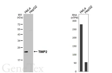 Anti-TIMP2 antibody [HL7032] used in Western Blot (WB). GTX649905