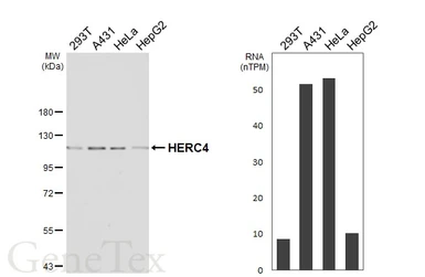 Anti-HERC4 antibody [HL7041] used in Western Blot (WB). GTX649914