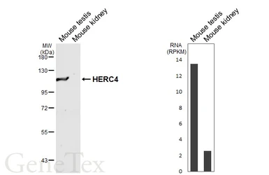 Anti-HERC4 antibody [HL7042] used in Western Blot (WB). GTX649915