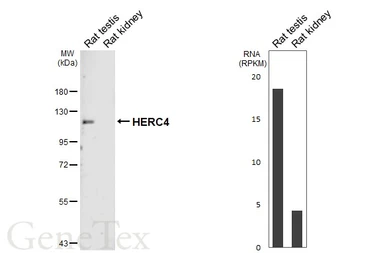Anti-HERC4 antibody [HL7042] used in Western Blot (WB). GTX649915