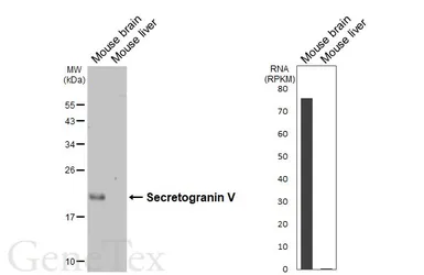Anti-Secretogranin V antibody [HL7043] used in Western Blot (WB). GTX649916