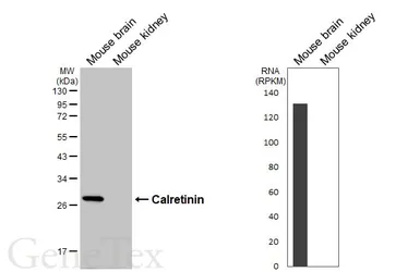 Anti-Calretinin antibody [GT468] used in Western Blot (WB). GTX649926