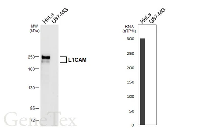 Anti-L1CAM antibody [GT470] used in Western Blot (WB). GTX649927