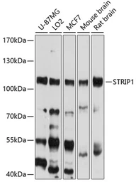 Anti-FAM40A antibody used in Western Blot (WB). GTX64994
