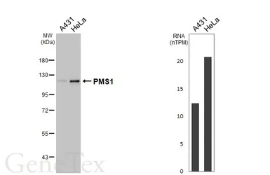 Anti-PMS1 antibody [HL7066] used in Western Blot (WB). GTX649948