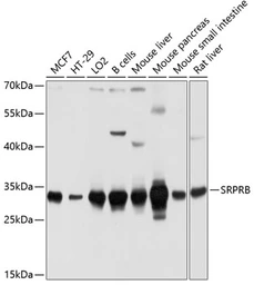 Anti-SRPR beta antibody used in Western Blot (WB). GTX64995