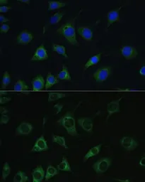 Anti-SRPR beta antibody used in Immunocytochemistry/ Immunofluorescence (ICC/IF). GTX64995