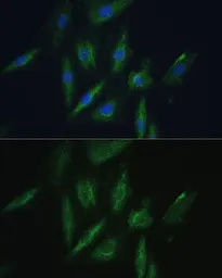 Anti-SRPR beta antibody used in Immunocytochemistry/ Immunofluorescence (ICC/IF). GTX64995