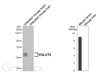 Anti-VGLUT2 antibody [HL7073] used in Western Blot (WB). GTX649955