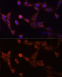 Anti-PSMD14 antibody used in Immunocytochemistry/ Immunofluorescence (ICC/IF). GTX64996