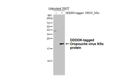 Anti-Oropouche virus NSs protein antibody [HL7083] used in Western Blot (WB). GTX649965