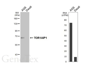Anti-TOR1AIP1 antibody [HL7085] used in Western Blot (WB). GTX649967