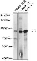 Anti-CDT2 antibody used in Western Blot (WB). GTX64998