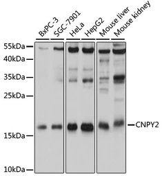Anti-CNPY2 antibody used in Western Blot (WB). GTX64999