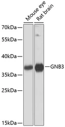 Anti-GNB3 antibody used in Western Blot (WB). GTX65528