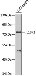Anti-IL18 Receptor 1 antibody used in Western Blot (WB). GTX65529