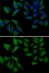 Anti-ATOX1 antibody used in Immunocytochemistry/ Immunofluorescence (ICC/IF). GTX65531