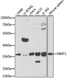 Anti-DIMT1 antibody used in Western Blot (WB). GTX65532