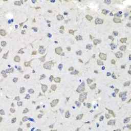 Anti-C1GALT1C1 antibody used in IHC (Paraffin sections) (IHC-P). GTX65533