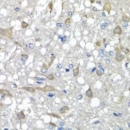 Anti-C1GALT1C1 antibody used in IHC (Paraffin sections) (IHC-P). GTX65533