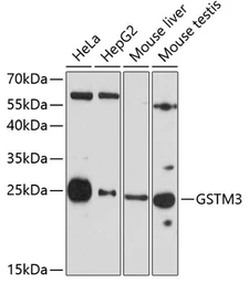 Anti-GSTM3 antibody used in Western Blot (WB). GTX65535