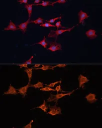 Anti-GSTM3 antibody used in Immunocytochemistry/ Immunofluorescence (ICC/IF). GTX65535
