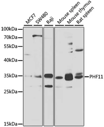 Anti-PHF11 antibody used in Western Blot (WB). GTX65536