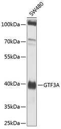 Anti-GTF3A antibody used in Western Blot (WB). GTX65539