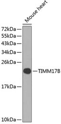 Anti-TIMM17B antibody used in Western Blot (WB). GTX65540