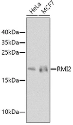 Anti-RMI2 antibody used in Western Blot (WB). GTX65541