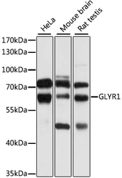 Anti-GLYR1 antibody used in Western Blot (WB). GTX65546
