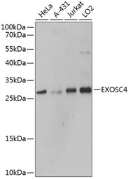 Anti-EXOSC4 antibody used in Western Blot (WB). GTX65547