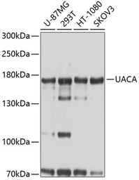 Anti-UACA antibody used in Western Blot (WB). GTX65549
