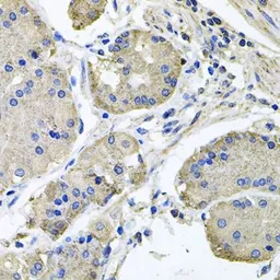 Anti-NDUFA6 antibody used in IHC (Paraffin sections) (IHC-P). GTX65550