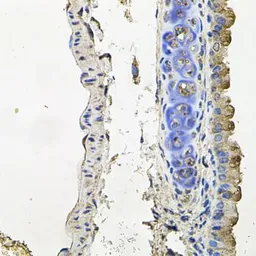 Anti-NDUFA6 antibody used in IHC (Paraffin sections) (IHC-P). GTX65550