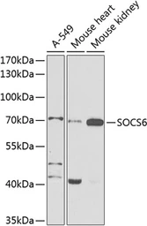 Anti-SOCS6 antibody used in Western Blot (WB). GTX65551